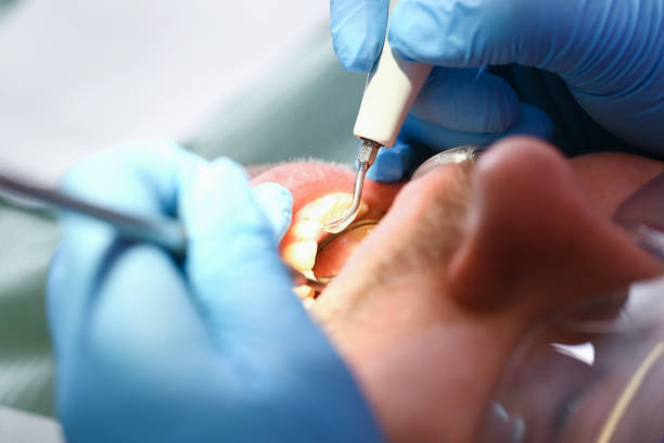 Best Emergency Treatment for Toothache in Okawvle, IL